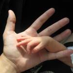 inferilitate (htt://2.bp.blogspot.com)